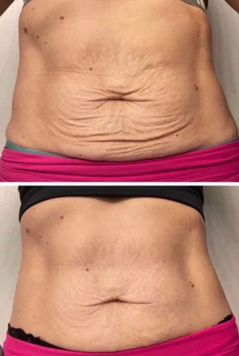 Nuskin ageLOC Dermatic Effects Contouring Body Lotion fl oz