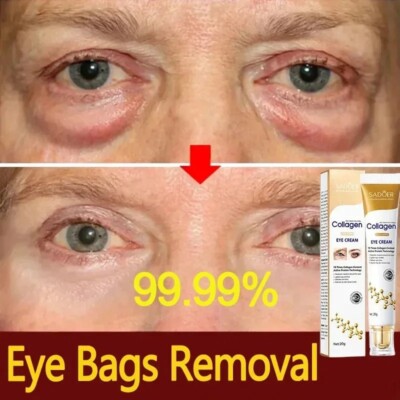 Remove Dark Circles Wrinkles Face Lines Puffy Eyes Under Eye Cream