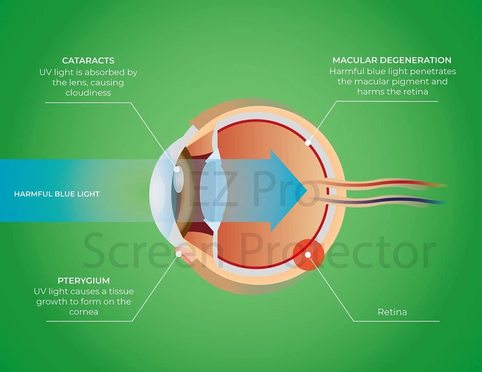 2PCS Anti Blue Light & Anti Glare Screen Protector for 13/14 inch 16:10 Laptop - Image 4 of 4