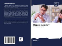 Rohit S. | Periimplantit | Taschenbuch | Russisch (2021) | Kratkoe Rukowodstwo