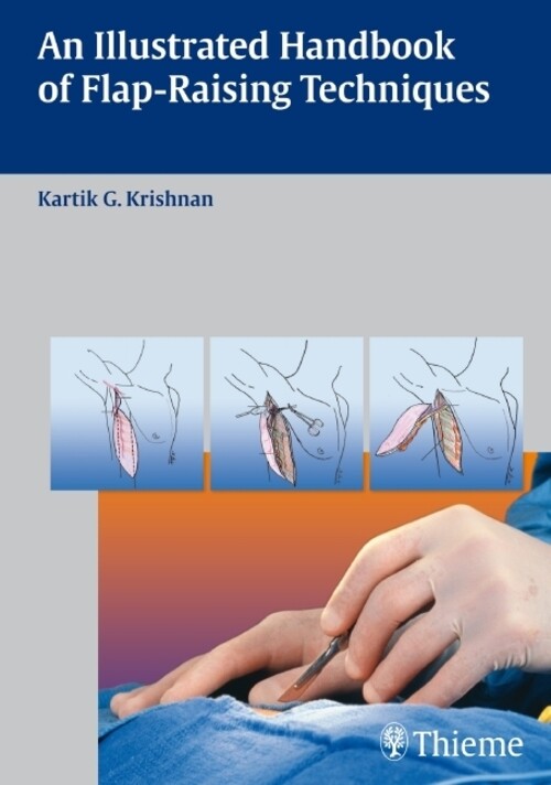 An Illustrated Handbook Of Flap-raising Techniques Kartik G. Krishnan