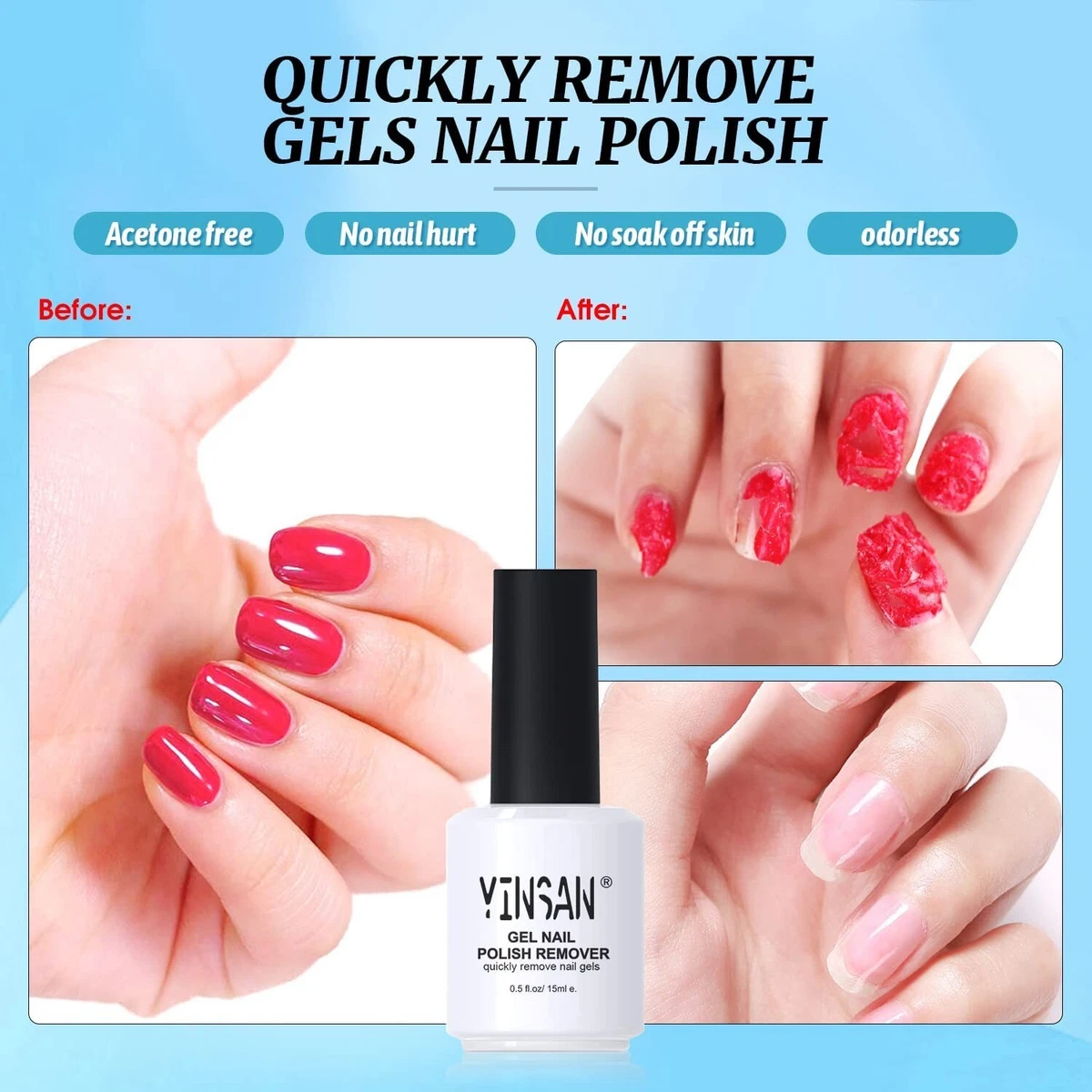 Aggregate more than 122 nails hurt after gel removal latest noithatsi.vn