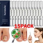 15 Pack Lunavia Antifungal Pen, 25% Undecylenic Acid – Toenail Fungus Treatment