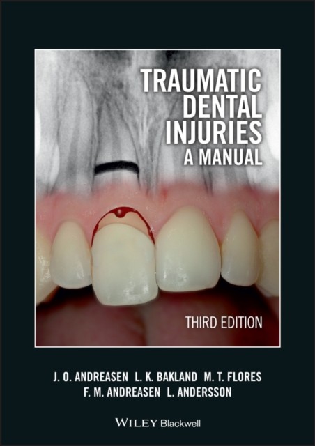 Traumatic Dental Injuries – A Manual 3e Andreasen Paperback Wiley–Blackwell
