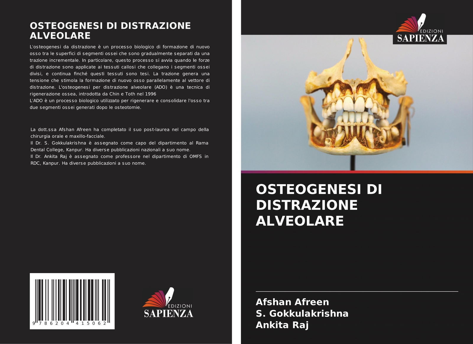 Thumbnail - Osteogenesi Di Distrazione Alveolare | Afshan Afreen (u. A.) |