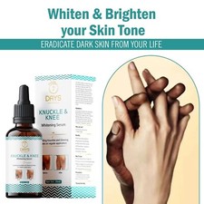 7 Days Skin Whitening Serum For Removing Dark Knuckles From Hand, Elbows, Knees.