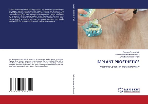 Implant Prosthetics Prosthetic Options In Implant Dentistry Naik (U. A.) Buch-image