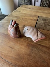 Altes Somso ? Lehrmodell Herz Und Lunge Anatomie Modell Vintage Anatomiemodell