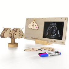 Pregnancy Milestone Countdown Board with Ultrasound Sonogram Picture Frame ...