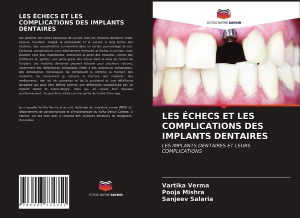 LES ÉChecs ET LES Complications DES Implants Dentaires Vartika Verma-image