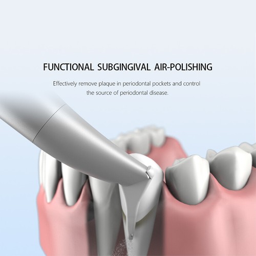 Escalador ultrasónico dental sistema de terapia periodontal pulidora de dientes de aire - Imagen 13 de 15