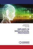 Shwetali Powar (U. A.) | Implants IN Maxillofacial Prostheses | Taschenbuch