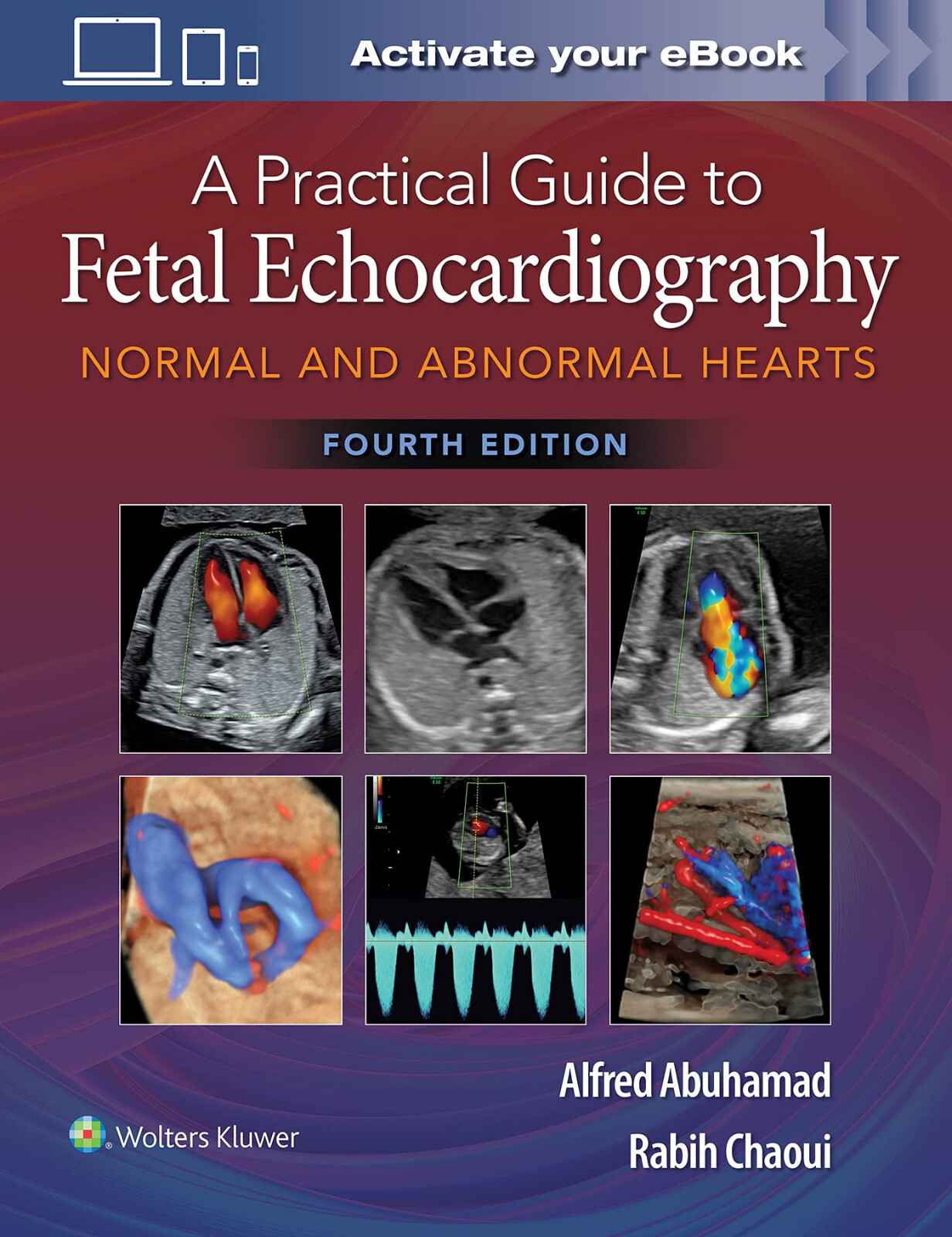 A Practical Guide to Fetal Echocardiography - Alfred Z. Abuhamad - 2022