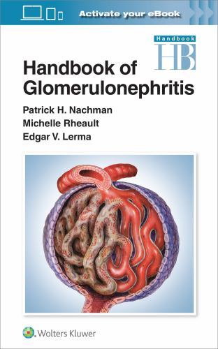 Handbook of Glomerulonephritis by Edgar . Lerma, Patrick Henry Nachman and ...
