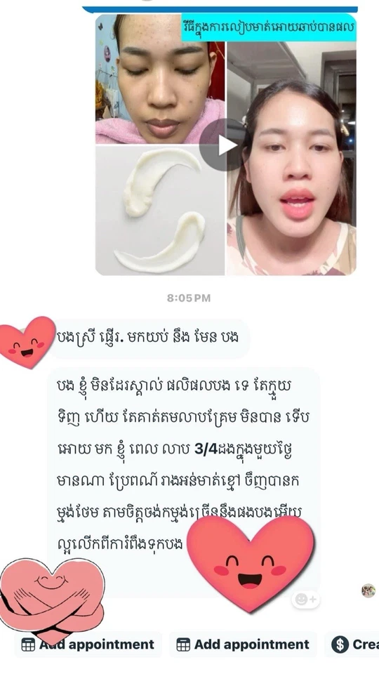 MT Dark Lip Solution 5g (គ្រីមព្យាបាលបូរមាត់ខ្មៅ MT) 5g Foto 4 de 4