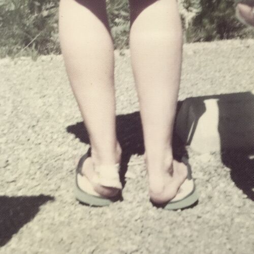 Vintage Color Photo Woman Feet Heels Bandage Sandals Legs Outdoors Injured - Afbeelding 1 van 4