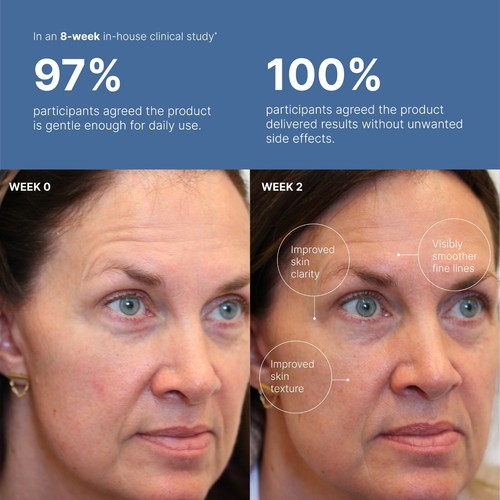 Complejo de retinol péptido facial Nu Skin NuSkin ageLOC Tru caducidad 01/2027 NUEVO EMBALAJE - Imagen 8 de 10