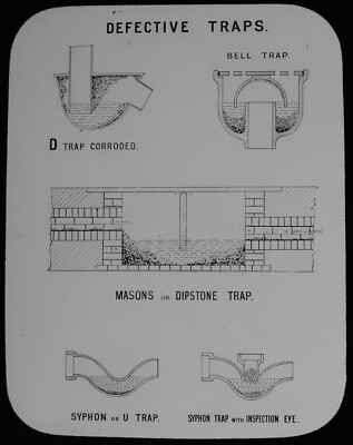 Magische Laternenrutsche DEFEKTE FALLEN UM 1895 VIKTORIANISCHE HYGIENE GESUNDHEIT MEDIZIN