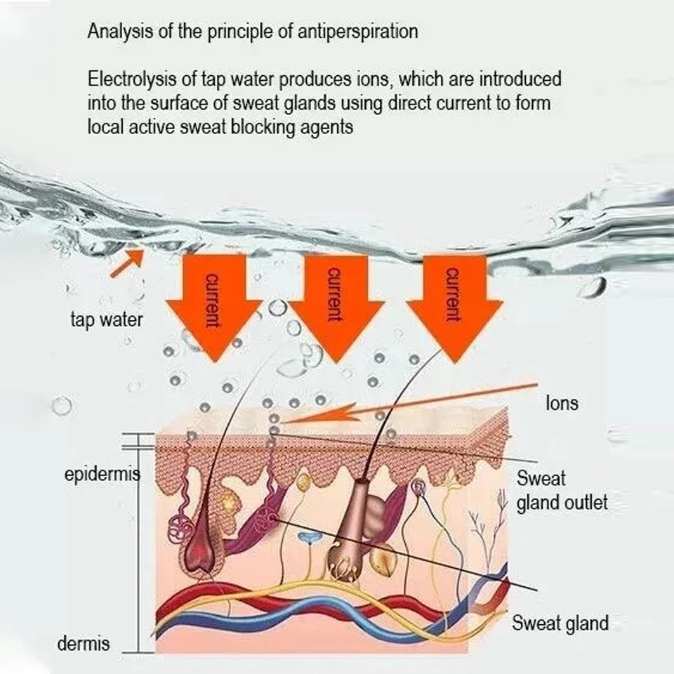 Hyperhidrosis Machine Iontophoresis Against Sweating Sweaty Hands Feet NEW - Image 4 of 4