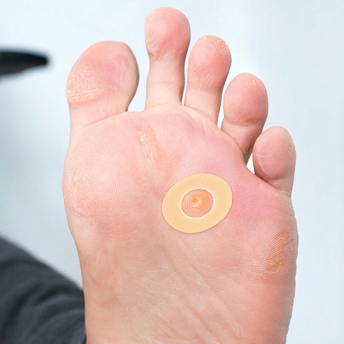 5 Sheets Callus Pads Round Hollow Corn Cushions Pads for Toe Protection - Picture 7 of 12