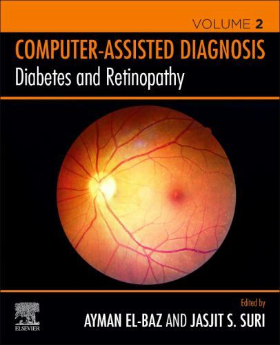 Diabetes and Retinopathy S. El-Baz Suri Paperback Elsevier 9780128174388
