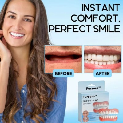 Instant Smile Natural Shade Complete Teeth Makeover Kit, Upper & Lower Veneers