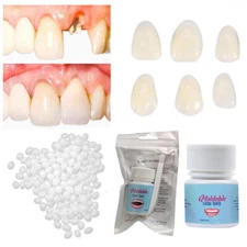 Temporary Tooth Repair Kit Resin Fix Broken False Teeth Fill Gap Dental Denture,