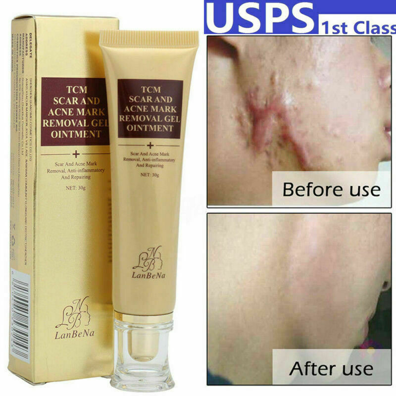 tcm scar and acne removal gel ointment