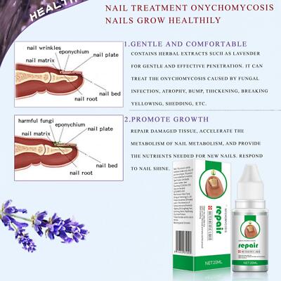 nails repair Solution Nagelerneuerung flüssig für beschädigte verfärbte gelbe Nägel