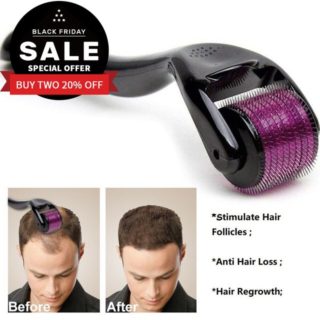 540 Microneedling Derma Roller Hair Beard Regrowth Anti Hair Loss