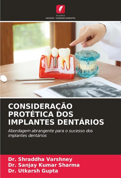 Shraddha Varshney (U. A.) | ConsideraÇÃO ProtÉTica DOS Implantes DentÁRios-image