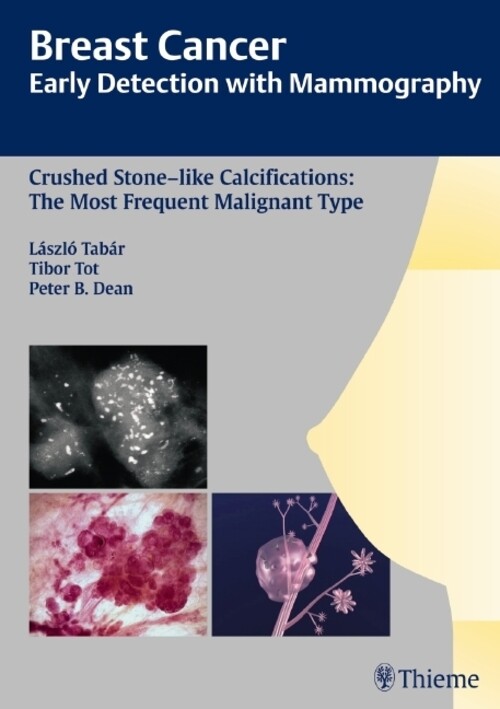 Thumbnail - Early Detection With Mammography | Laszlo Tabar (u. A.) | Buch | 320