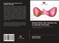 Exploration Des LéSions De La Glande ThyroïDe Aqeel Ahmad