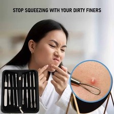 9 Pcs Professional Kit - Pimple Removal Tool for Whiteheads and Deep Cleansing