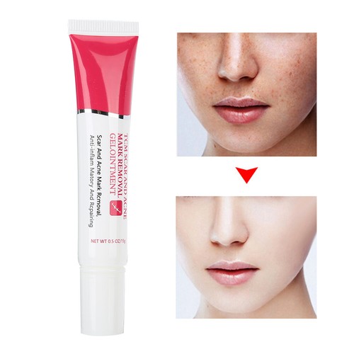TYJR Scar Removal Cream Face Body Repair Gel Skin Repair Dark Spot Cream 15 AU - Picture 5 of 12