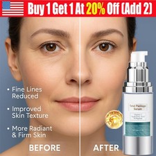 NEW Total Package Serum, All-In-One Vitamin C, Hyaluronic Acid, Peptides Serum