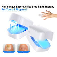 Nail Fungus Laser Treatment 940nm 500nm Blue Light Infrared Device for Toenails