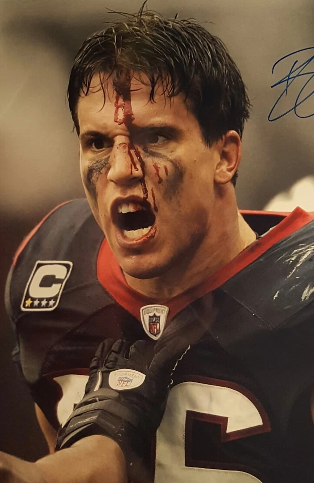 Brian Cushing Signed Houston Texans 16x20 "Bloody" Photo - JSA WITNESSED COA - Image 3 of 4