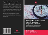 Topografia Na CiêNcia Do CâNcer De CóLon Esquerdo E Direito Mauro Luisetto