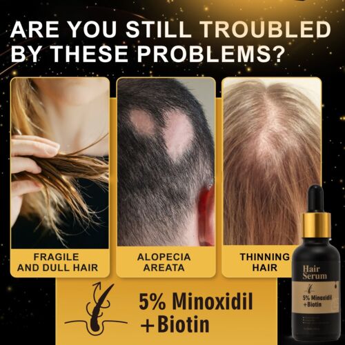 5% Minoxidil+Biotin for Hair Growth Serum & Hair loss regrowth for Men Women - Picture 4 of 14