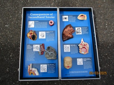 Health Edco 2nd Hand Smoke Health Display