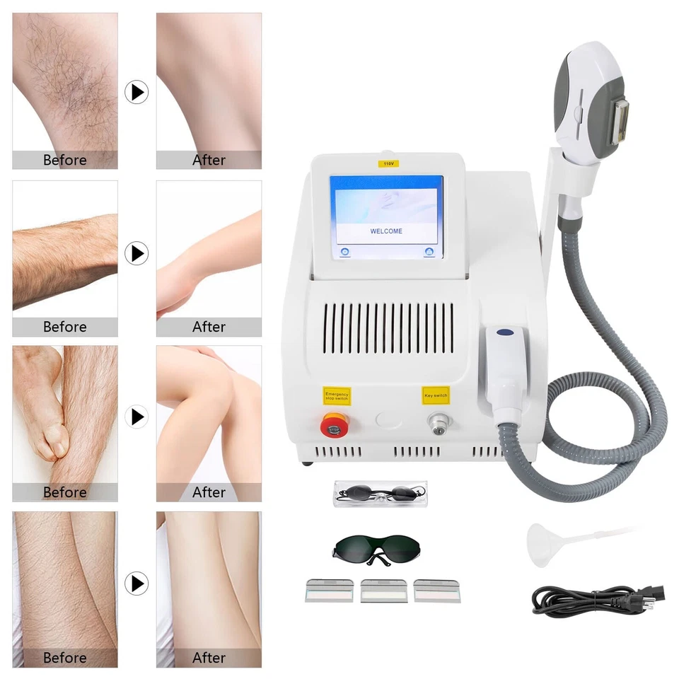 New IPL Hair Removal Laser Skin Rejuvenation Spot Pigment Removal Beauty Machine - Image 3 of 4