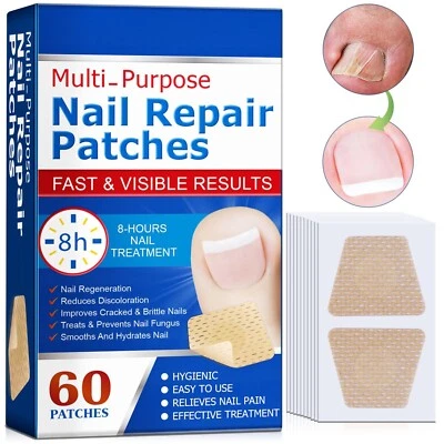 RUOJIAR 60Pcs Nail Repair Patches,Fungal Nail Treatment,Keratin Nail Treatment