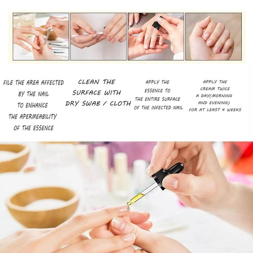 Ginger Nail Treatment Nail Care, Nail Growth Oil for Cuticle Nourishment New~~ - Picture 8 of 12