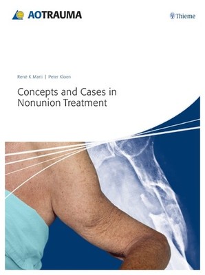 Concepts and Cases in Nonunion Treatment | René K. Marti, Peter Kloen | englisch