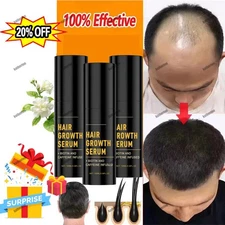 3x HaloGrow Hair Growth Spray 100ml Natural Hair Thickening Gentle Regrowth Mist