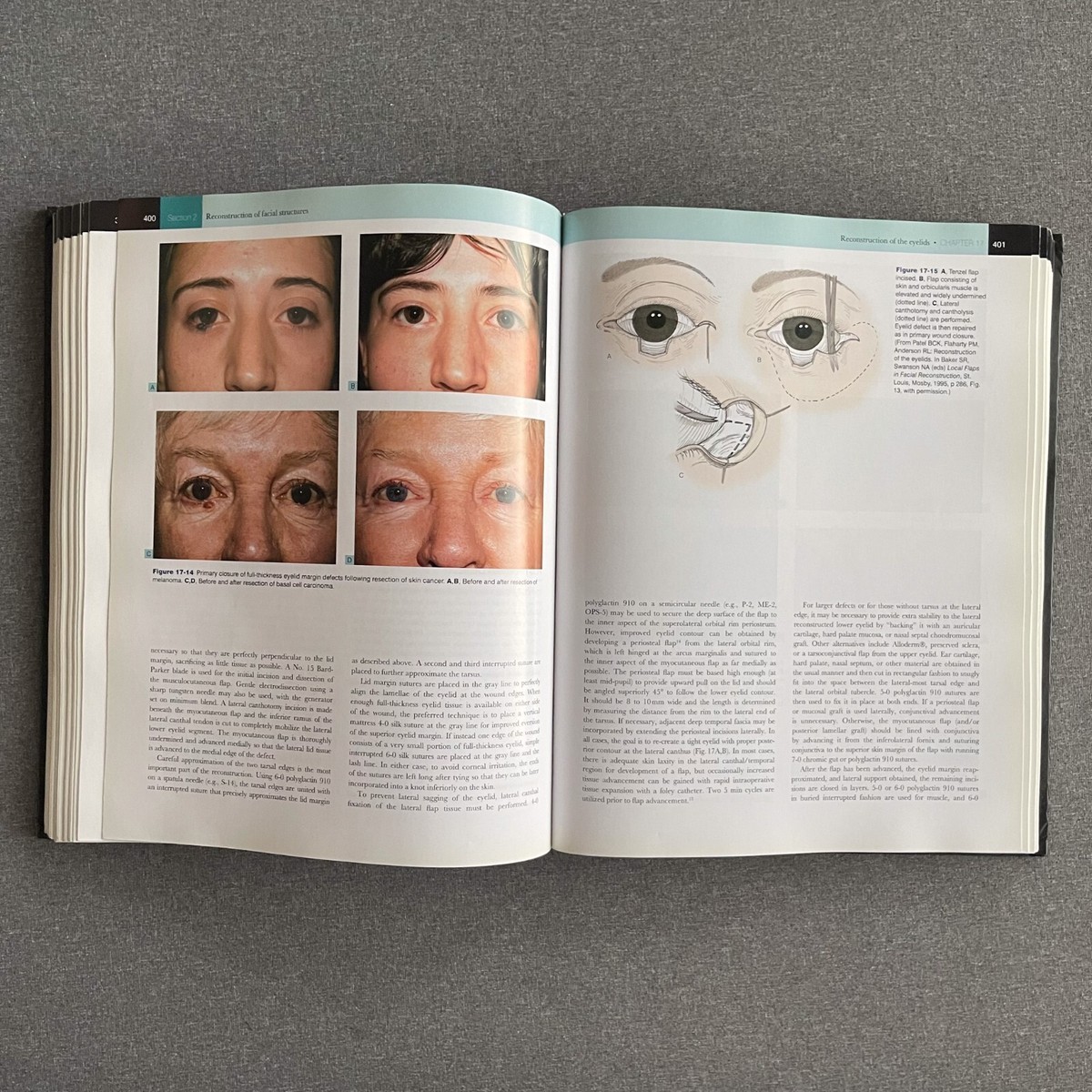 Shan R Baker - Local Flaps in Facial Reconstruction NO DVD