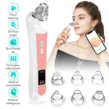 Blackhead Remover W Camera Extraction 3 Adjustment Modes & 6 Suction Heads