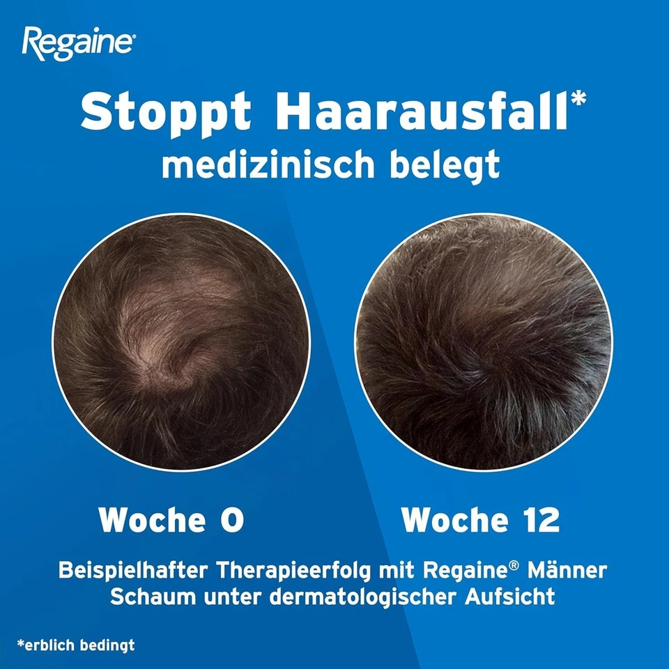 Regaine Männer Lösung 5% Minoxidil 3x60ml Haarausfall Geheimratsecken Glatze - Bild 4 von 4