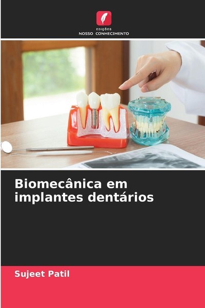 BiomecâNica Em Implantes DentáRios Sujeet Patil-image